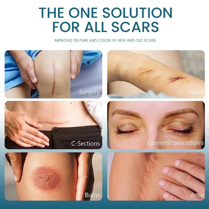 Créme magique traite les cicatrice ancienne et récente, vergetures,acnés, cheloïde, boutons...